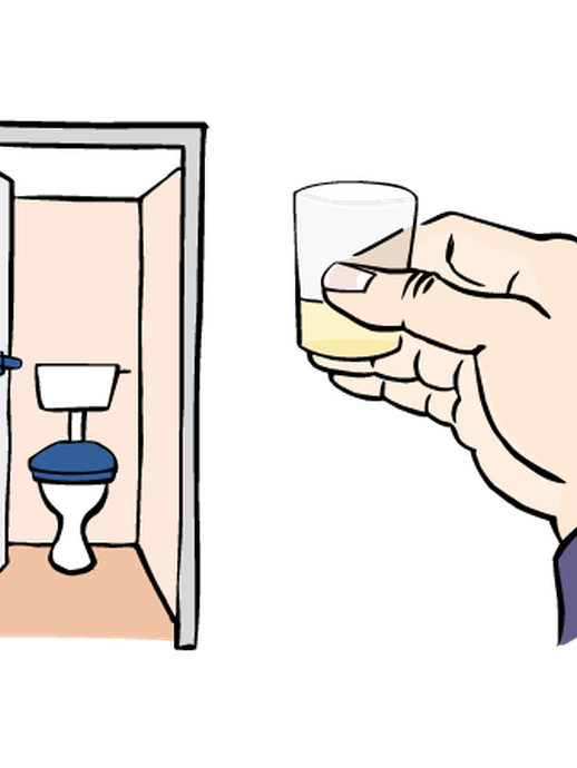 Urinprobe (vergrößerte Bildansicht wird geöffnet)